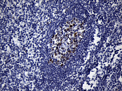BCL6 Antibody