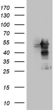 MAPKAPK5 Antibody