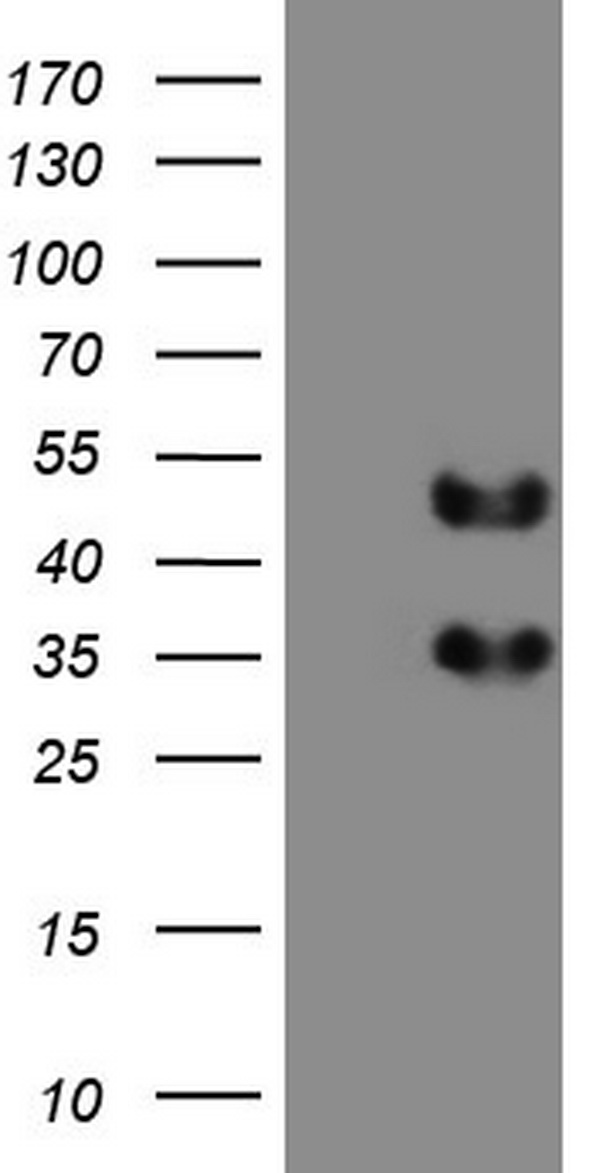 FOSB Antibody