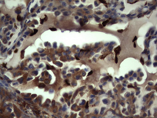 S100A9 Antibody