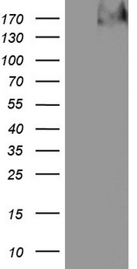 Thyroglobulin Antibody