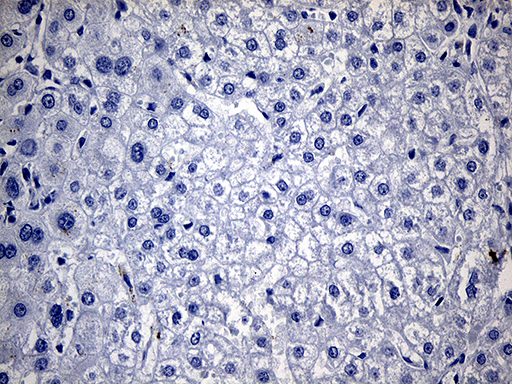 TG Antibody