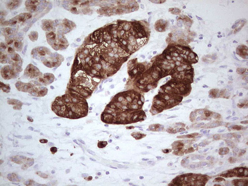 N4BP2L2 Antibody