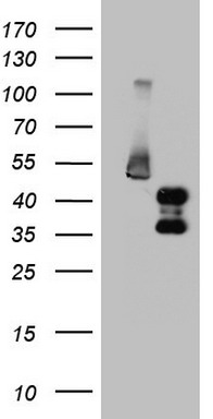 FOSB Antibody