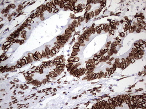 BCL6 Antibody