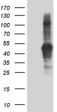 TACC2 Antibody