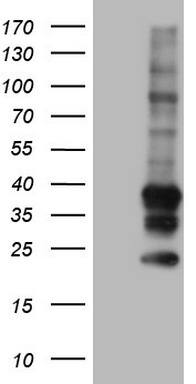 TACC2 Antibody