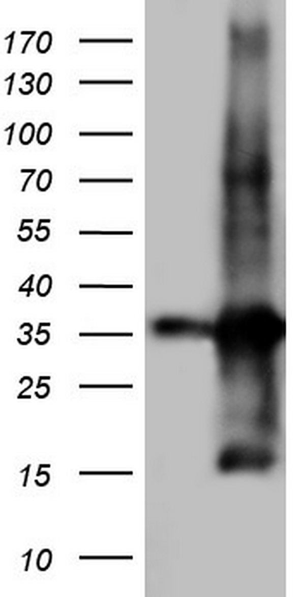 TACC2 Antibody