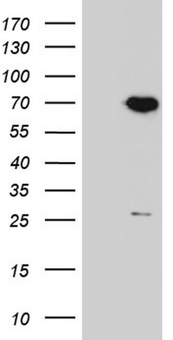 PPP2R5D Antibody