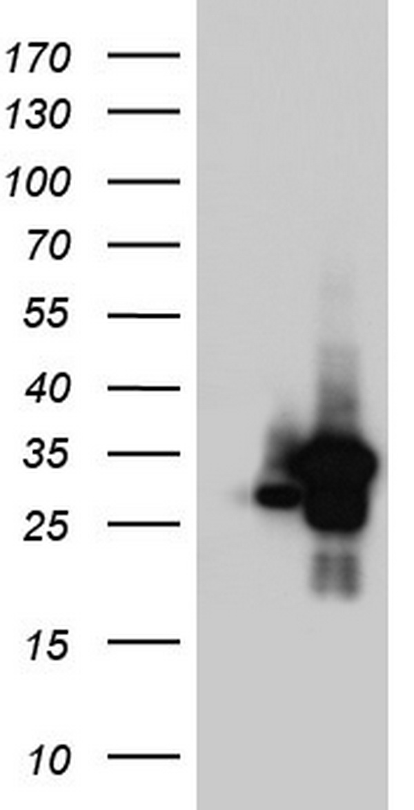 C14orf166 Antibody