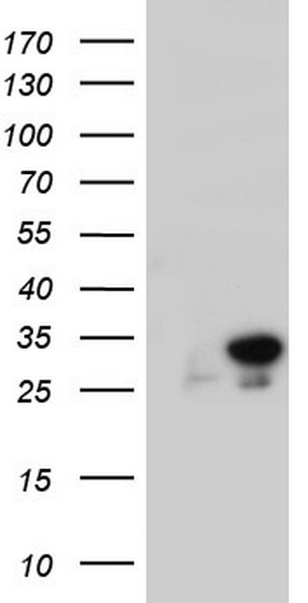 C14orf166 Antibody