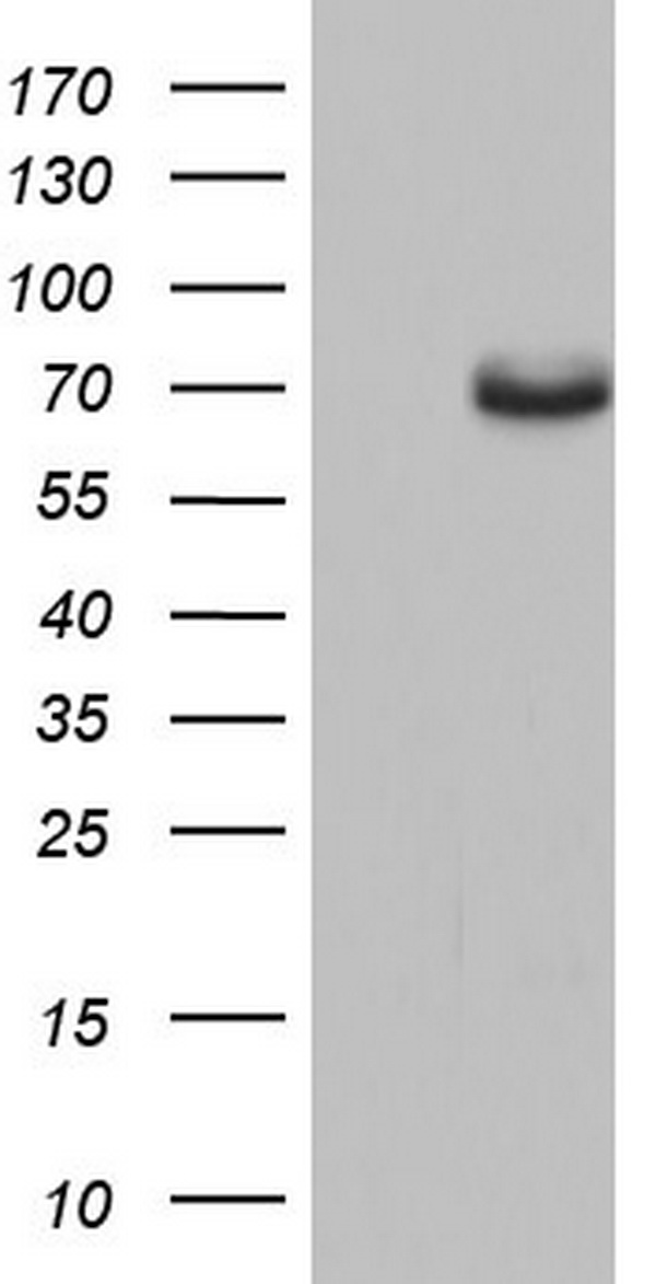 ESR1 Antibody