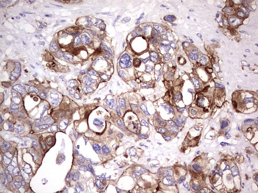 CD30 Antibody