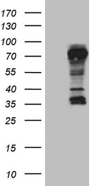 CD30 Antibody