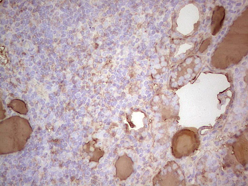 Thyroglobulin Antibody