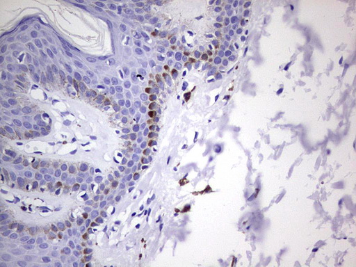 GLI1 Antibody