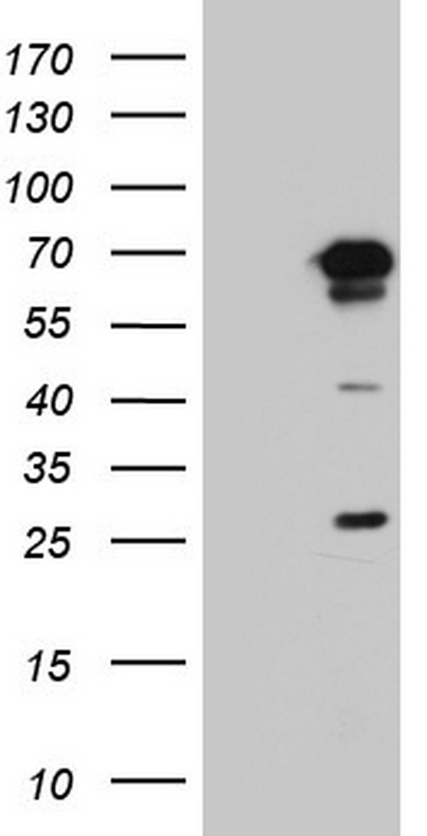 PPP2R5D Antibody