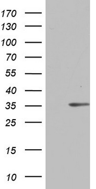C14orf166 Antibody