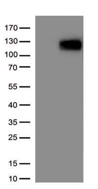 Angiotensin Converting Enzyme 2 Antibody