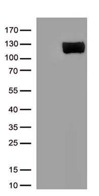 Angiotensin Converting Enzyme 2 Antibody