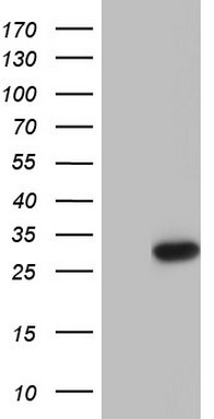 PTCH1 Antibody