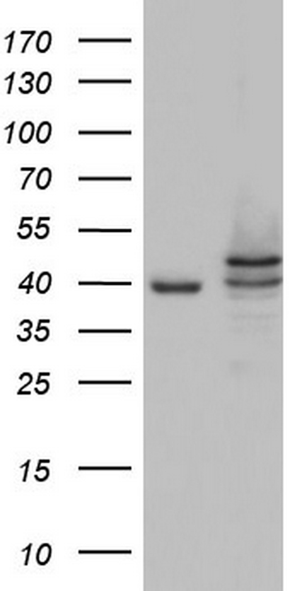CSNK1E Antibody