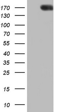 PTCH1 Antibody