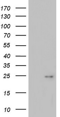 ITGB1BP1 Antibody