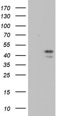 TRIM54 Antibody