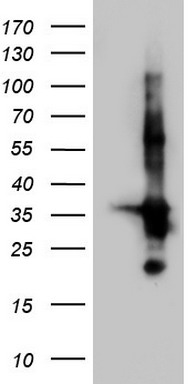 TACC2 Antibody