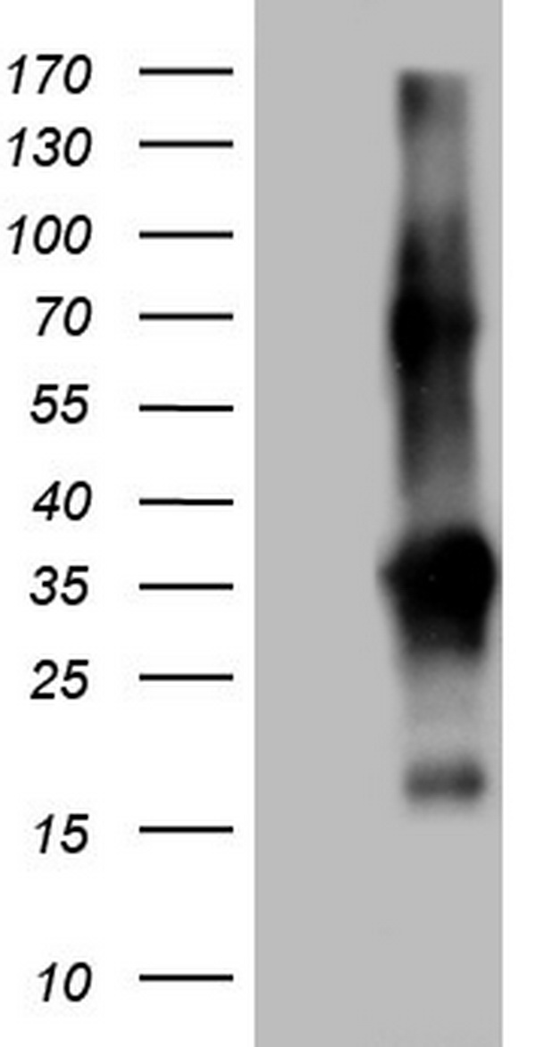 TACC2 Antibody