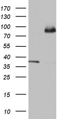 ABCD1 Antibody