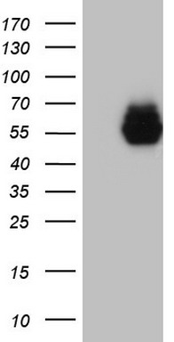 Cytokeratin 19 Antibody