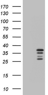 CHCHD3 Antibody
