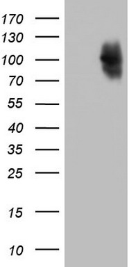 Melanoma gp100 Antibody