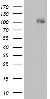 Melanoma gp100 Antibody