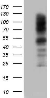 CEACAM5 Antibody