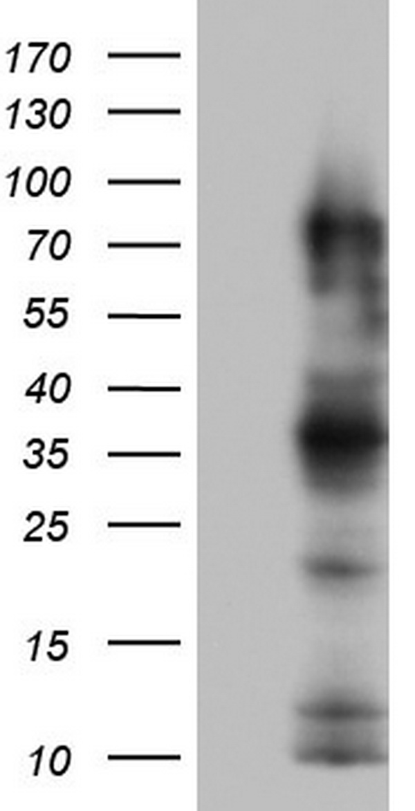 CEACAM5 Antibody