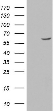 GBA Antibody