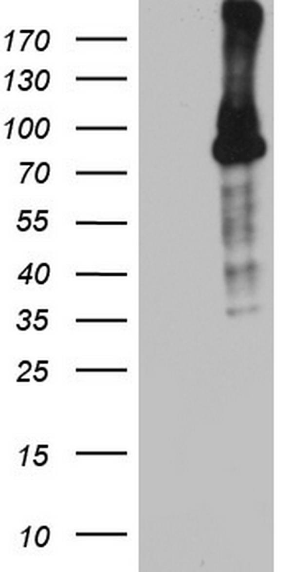 BCL6 Antibody