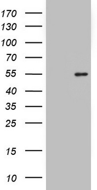 TTF1 Antibody