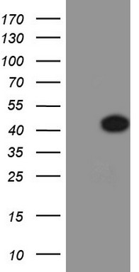 TTF1 Antibody
