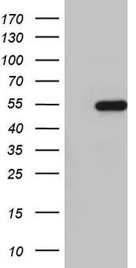 TTF1 Antibody