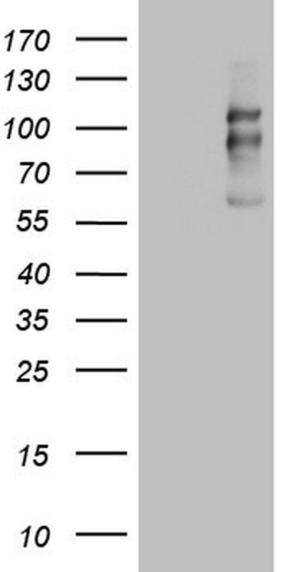 E Cadherin Antibody