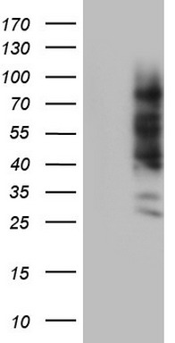 CEACAM5 Antibody