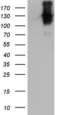 CEACAM5 Antibody