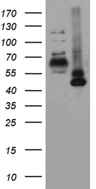 RORA Antibody