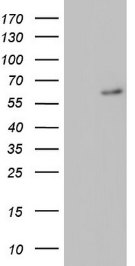 RORA Antibody