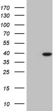 TTF1 Antibody