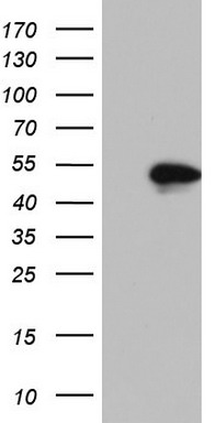 TTF1 Antibody